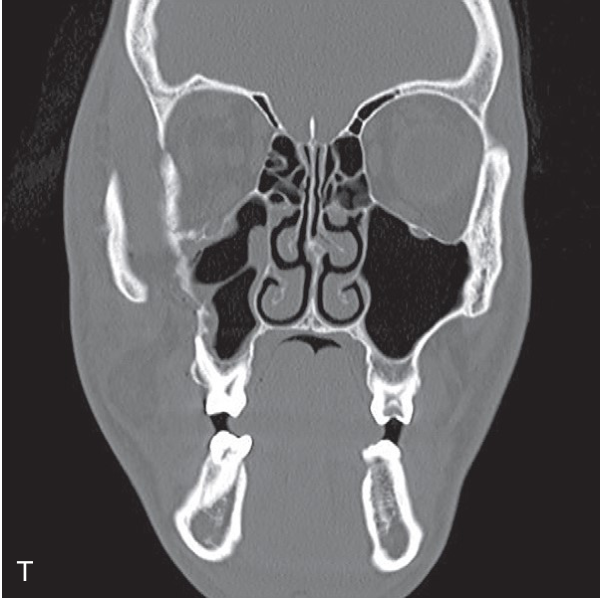FIGURE 16-16, cont’d