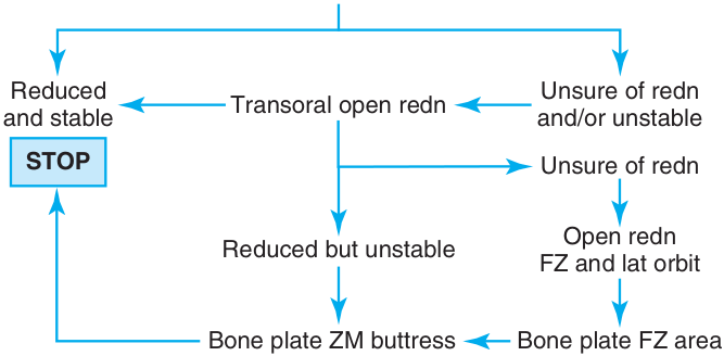 FIGURE 16-35 Treatment algorithm for ZMC fracture without the need for internal orbital reconstruction.